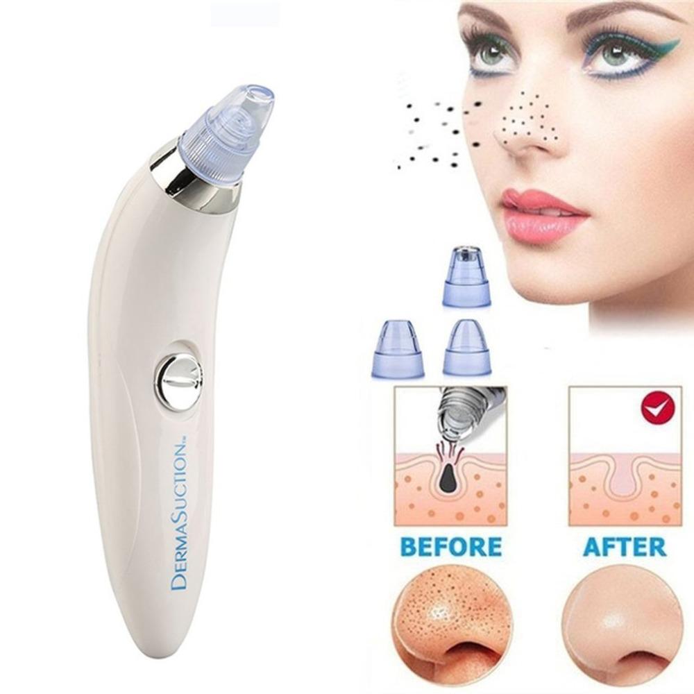 Electric Blackhead and Whitehead Remover Machine with Suction Technology for Deep Pore Cleansing, Skin Rejuvenation, and Acne Prevention at Home